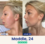 Velvinor™ | Chinology Masque Liftant V-Line