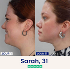 Velvinor™ | Chinology Masque Liftant V-Line
