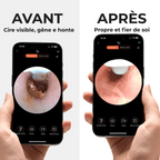 Velvinor™ | Nettoyeur d’Oreilles avec Caméra HD