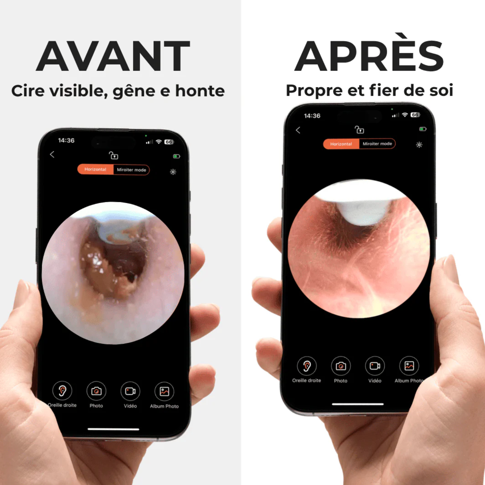 Velvinor™ | Nettoyeur d’Oreilles avec Caméra HD