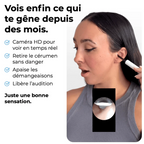 Velvinor™ | Nettoyeur d’Oreilles avec Caméra HD