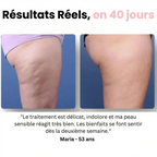 Masseur Drainant Anti-Cellulite