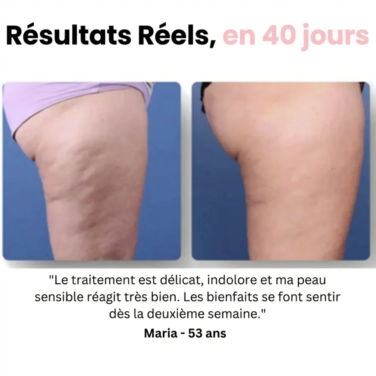 Masseur Drainant Anti-Cellulite