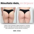 Masseur Drainant Anti-Cellulite