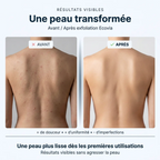 Serviette Exfoliante Ecovia