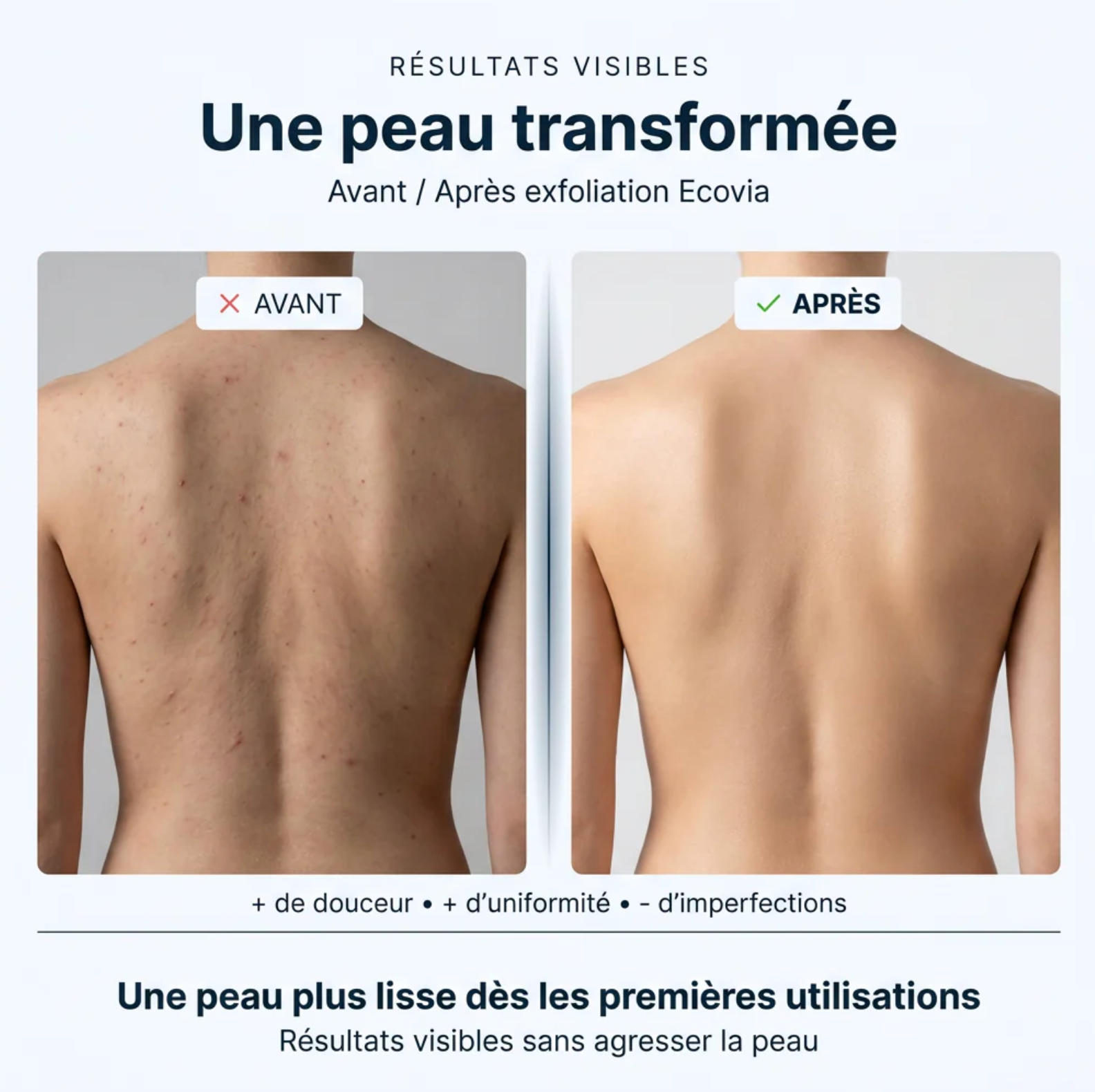 Serviette Exfoliante Ecovia