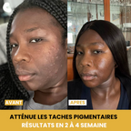 Savon au Curcuma