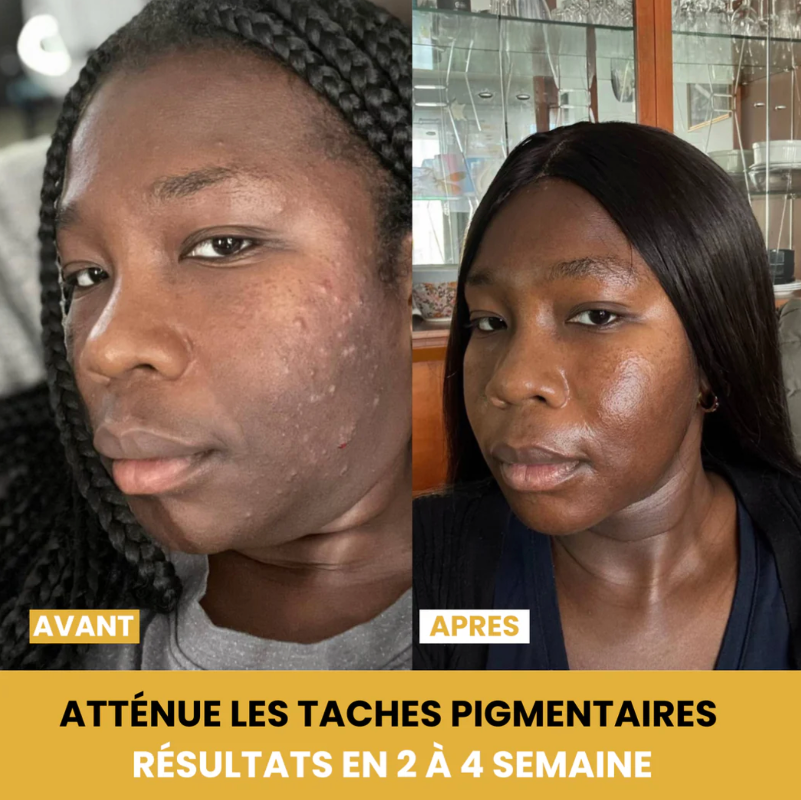 Savon au Curcuma